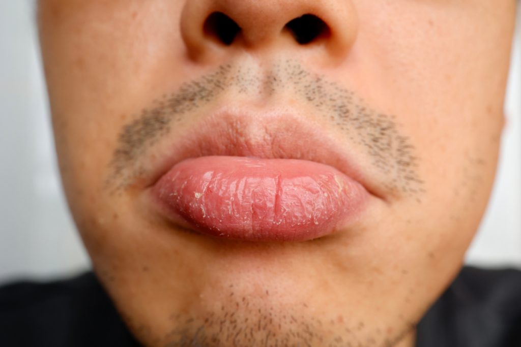 唇 乾燥
